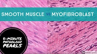 Myofibroblasts vs Smooth Muscle Made Easy 5Minute Pathology Pearls [upl. by Disraeli733]