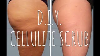 Coffee Body Scrub  How to get rid of your CELLULITE at home NATURALLY  ItsAllAboutSaw [upl. by Mendez108]