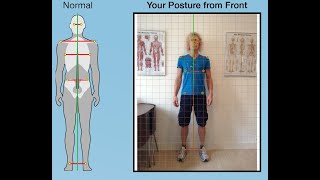 Postural Assessment Guide [upl. by Mclaughlin464]