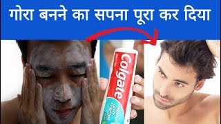 गोरा होने का तरीका Skin Whitening  Gora Hone Ka Tarika  Rang Gora Karne Ke Gharelu Upay [upl. by Gawlas371]