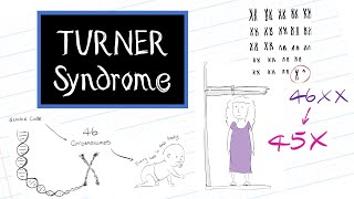 What is Turner Syndrome HealthSketch [upl. by Ardnaed203]