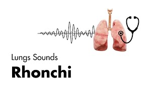 Rhonchi  Lung Sounds  Medzcool [upl. by Denys]