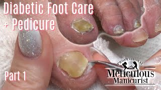 Diabetic Foot Care Tips and Pedicure Tutorial Part 1 [upl. by Pownall]