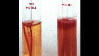 Motility Determination in Bacteria  Amrita University [upl. by Eenram]