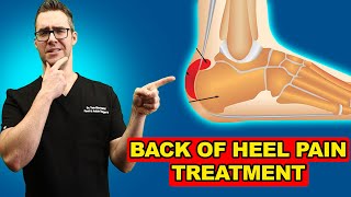 Retrocalcaneal Heel BURSITIS Treatment Heel Pain Exercises amp Massage [upl. by Thornie]