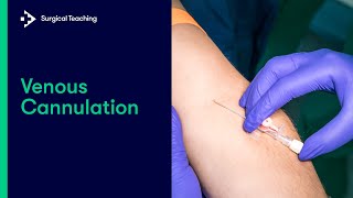 Cannulation How to gain IV access [upl. by Kaleena]