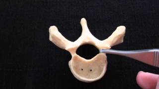 Typical Vertebra  Spinal column  Anatomy [upl. by Lichtenfeld418]