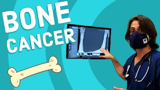 Bone Cancer Causes Signs and Symptoms Diagnosis and Treatment [upl. by Ebert]