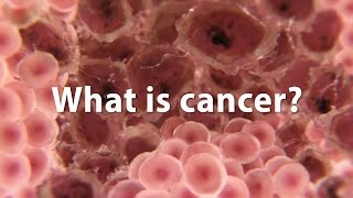 What is cancer What causes cancer and how is it treated UPDATE [upl. by Trista146]