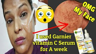 I Used NEW Garnier Vitamin C Serum For A Week See ResultGARNIER VITAMIN C SERUM REVIEWShinny Roops [upl. by Dilahk423]