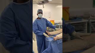 Lower Limb Lipoedema Liposuction  Part Three  Stage 3 Lipoedema [upl. by Gregory]