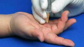 Hand Injection Techniques  Intermetacarpal Injections [upl. by Yorle]