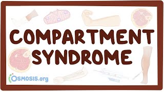 Compartment syndrome  an Osmosis Preview [upl. by Nerwal]