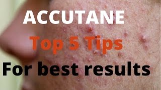 Accutane 5 tips by Dermatologists [upl. by Yenaiv]