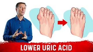 4 Ways to Neutralize Uric Acid [upl. by Harhay415]