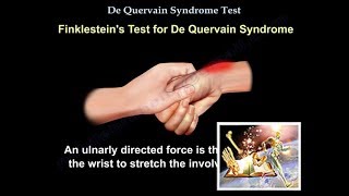 De Quervain Syndrome Test  Everything You Need To Know  Dr Nabil Ebraheim [upl. by Raynold]