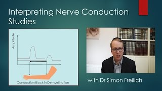 Interpreting Nerve Conduction Studies [upl. by Odille]