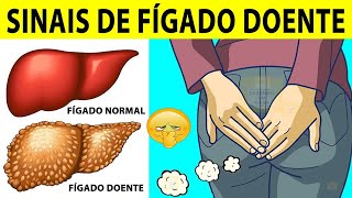 10 Sinais de FÍGADO Doente [upl. by Gisser6]