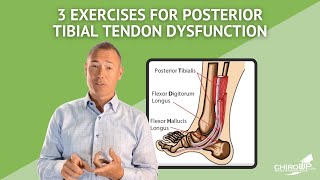 3 Exercises for Posterior Tibial Tendon Dysfunction [upl. by Aynav863]