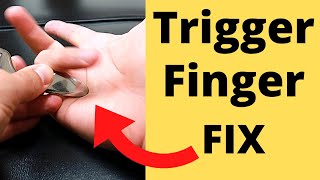 FIX Trigger Finger in 5 Minutes 3 Steps [upl. by Torrie]