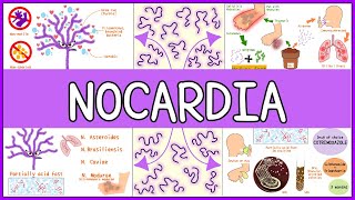 Nocardia Microbiology Morphology Pathophysiology Symptoms Diagnosis Treatment [upl. by Arriet]