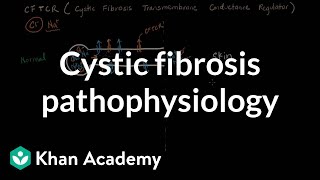 Cystic fibrosis pathophysiology  Respiratory system diseases  NCLEXRN  Khan Academy [upl. by Ajnotal]