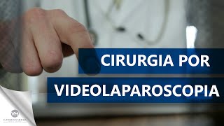 Cirurgia por Videolaparoscopia [upl. by Renrag]