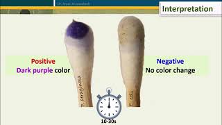 Oxidase Test Five Methods [upl. by Granville285]