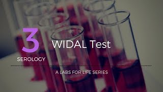 Widal test [upl. by Iznyl]