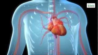 Explaining the Procedure Peripheral Angiogram [upl. by Mccomb101]