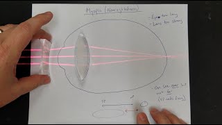 Vision Correction Normal Eyes Myopia Hyperopia Near amp Far Point Lens Power [upl. by Milt865]