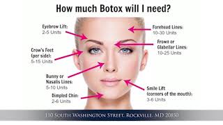 Basics of Botox Injection [upl. by Mooney]