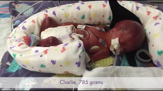 The Gardner Story  Baby Charlie  Born at 25 Weeks [upl. by Carlina]