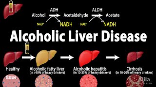 Alcoholic Liver Disease Animation [upl. by Theona303]