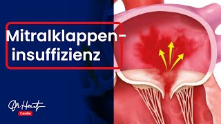 Mitralklappeninsuffizienz  einfach erklärt  DrHeart [upl. by Gaut941]