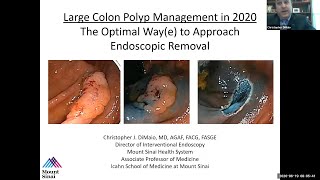 Large Colon Polyp Management in 2020 The Optimal Waye to Approach Endoscopic Removal [upl. by Melonie]