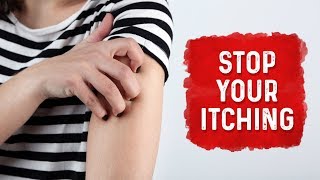 What Causes Hives and Itchiness  Urticaria Hives Treatment  Dr Berg [upl. by Ahseal]