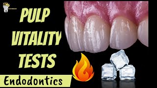 ENDODONTICS  PULP VITALITY TESTS MADE EASY [upl. by Limaj]