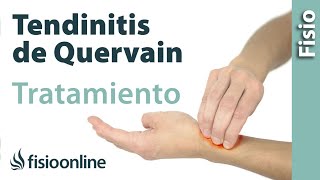 Tendinitis de De Quervain  Tratamiento con ejercicios automasajes y estiramientos [upl. by Kellen]