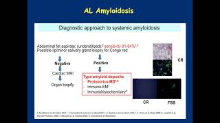 Light Chain AL Amyloidosis Diagnosis and Treatment [upl. by Nochur]