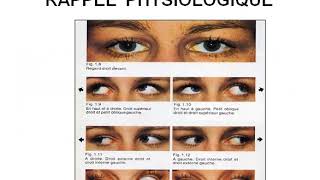 Troubles de la motilité oculaire Diplopie Strabisme [upl. by Rasec]