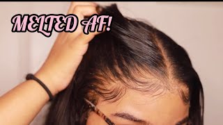 How to RE Install Frontal Wigs for Beginners  VERY DETAILED  Melt Transparent Lace [upl. by Neila]