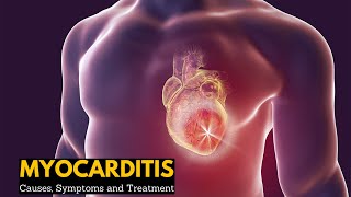 Myocarditis Causes Signs and Symptoms Diagnosis Treatment [upl. by Ahtebat573]