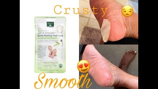 I TRIED A FOOT PEEL MASK  FOOT CARE [upl. by Penney]