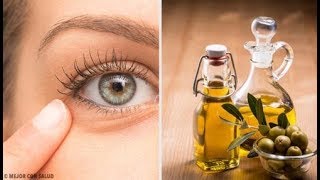 6 remèdes naturels contre l’inflammation oculaire  Santé Nutrition Beauté [upl. by Jamaal]