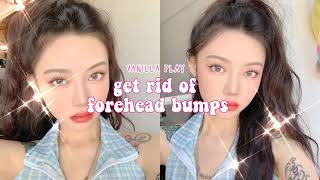 ✿ heal forehead bumps [upl. by Oretos]