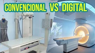 RADIOLOGIA CONVENCIONAL VS DIGITAL [upl. by Elfrida]