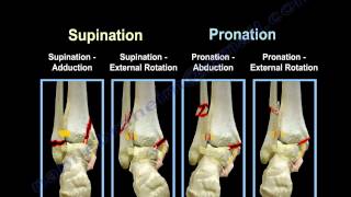 Ankle Fractures Lauge Hansen Introduction  Everything You Need To Know  Dr Nabil Ebraheim [upl. by Newcomer764]