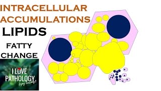 INTRACELLULAR ACCUMULATIONS LIPIDS Fatty Change [upl. by Ayanad]