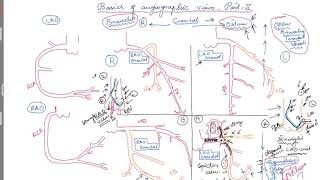 Cardiac Catheter Ablation What to Expect [upl. by Donny647]